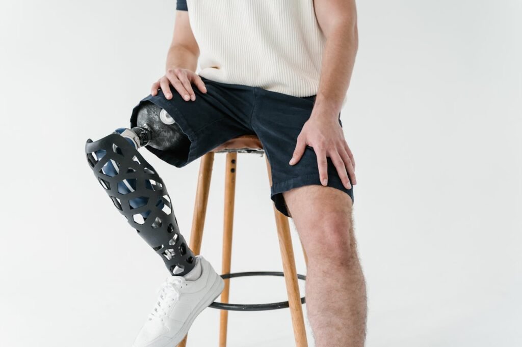 The Role of the Prosthetic Knee