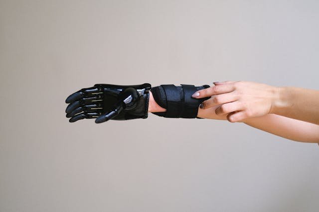 A major breakthrough in biomechanical prosthetics is AI-driven motion analysis