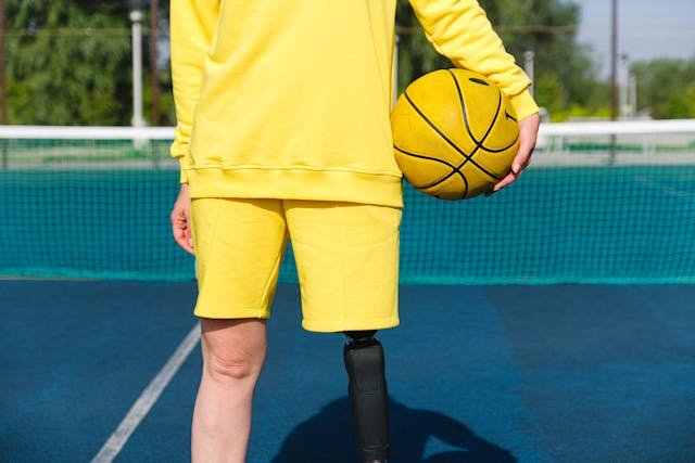 Gaining confidence with a prosthetic leg takes time. It’s not just about putting it on