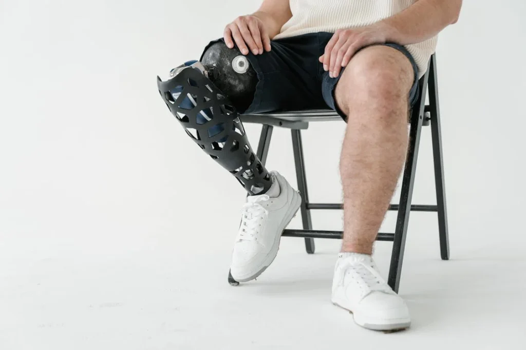 Many people think rehabilitation is only about learning to walk. But for someone with a lower limb amputation, it’s about far more than that. Rehab is where the body, mind, and prosthetic all start to work as a team. It’s where energy efficiency is built, one day at a time.