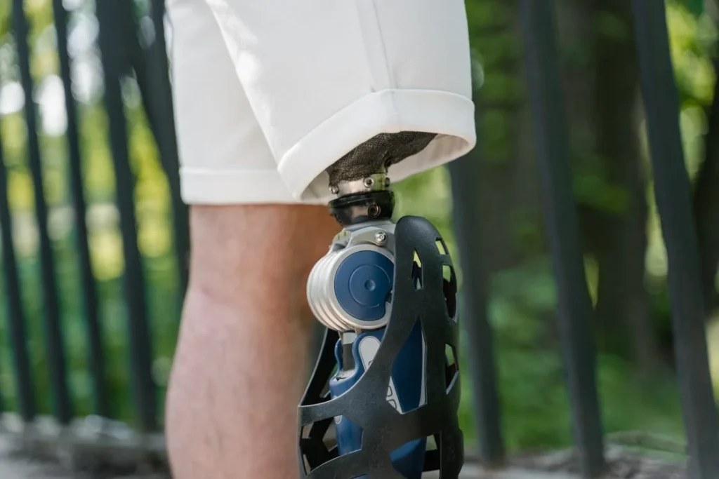When it comes to prosthetics, timing is not just helpful—it’s transformative. Getting fitted early doesn’t just mean walking sooner. It means healing better, faster, and more completely.